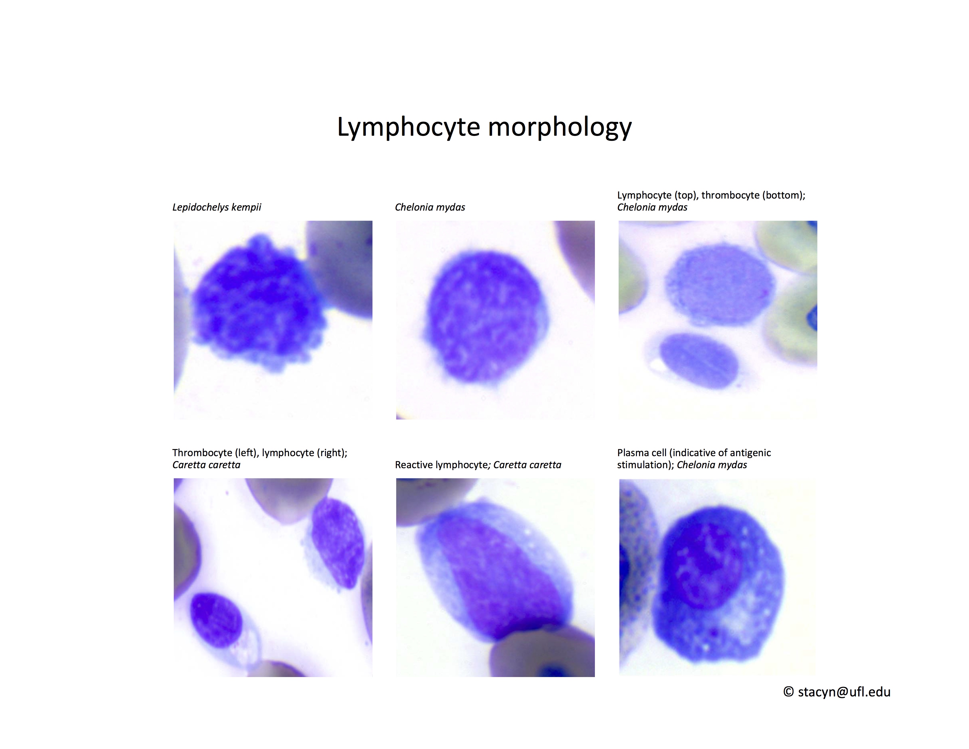 Fig.10Lymphocytes